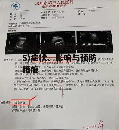 二、胎儿酒精综合征的影响