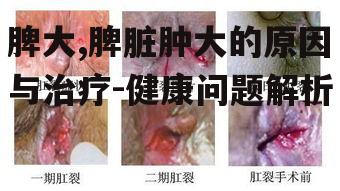 脾大,脾脏肿大的原因与治疗-健康问题解析