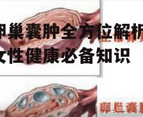 卵巢囊肿全方位解析-女性健康必备知识