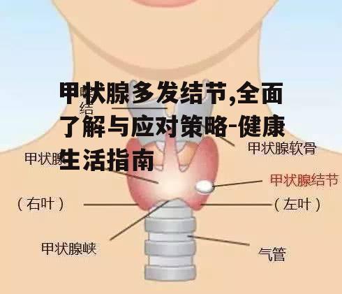 甲状腺多发结节,全面了解与应对策略-健康生活指南